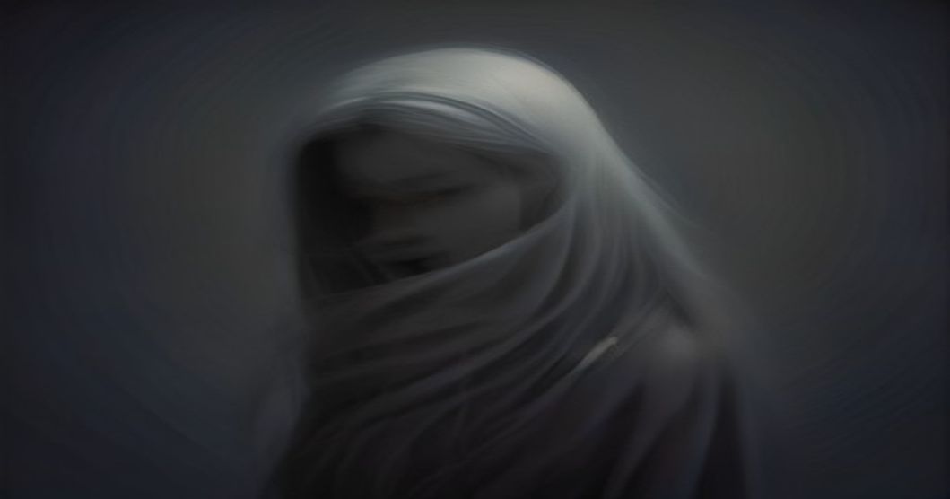이마가 넓어 고민이라면? M자 헤어라인, 높은 이마 유형별 접근법