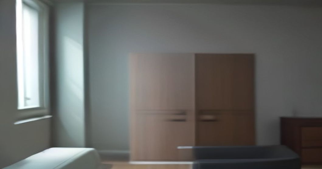 헤어라인교정 후 회복 기간은 얼마나 걸릴까요? 일상 복귀는 언제쯤 가능할까요?