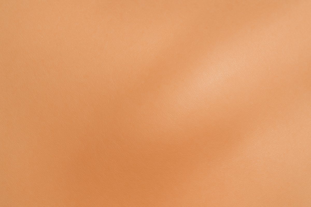 Are there other factors that can influence the total Thermage FLX cost?